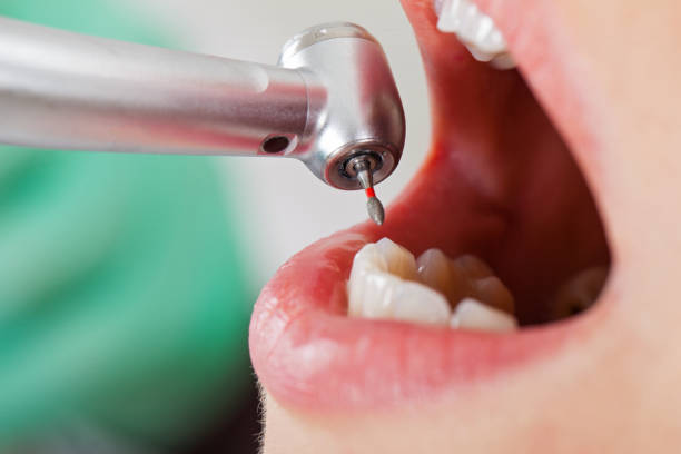 Best Urgent Care for Lost Fillings or Crowns in Hargill, TX
